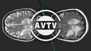 AVTV - Le changement d'heure