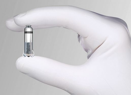 CHR : le plus petit stimulateur cardiaque au monde implanté avec succès 